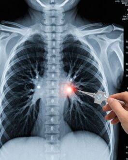 Lung Cancer Protocol